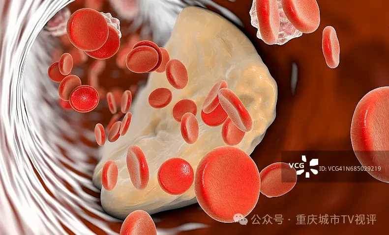 「膽固醇冠軍」被發現！千萬不要再吃了，含量是肥肉的24倍，很多人天天在吃