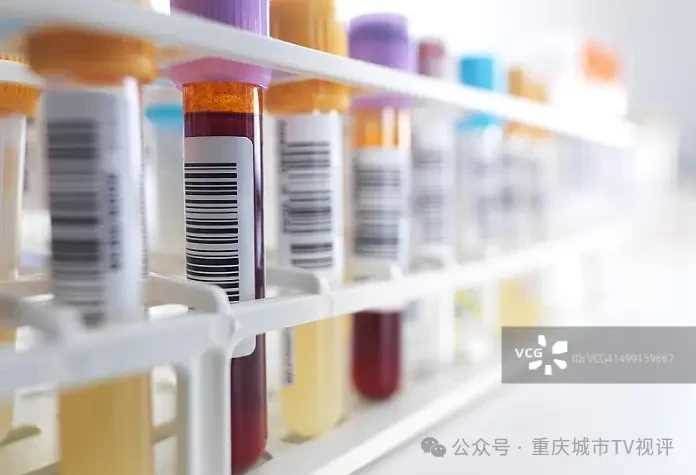 「膽固醇冠軍」被發現！千萬不要再吃了，含量是肥肉的24倍，很多人天天在吃