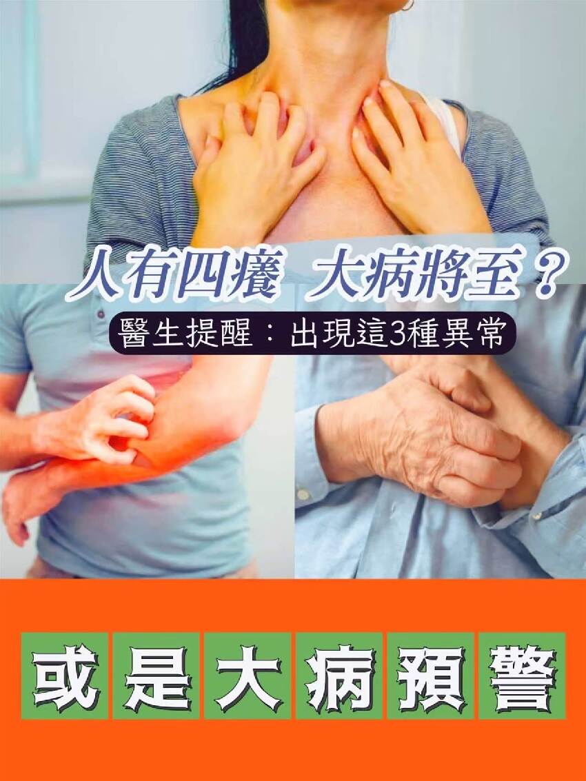 人有四癢，大病將至？醫生提醒：出現這3種異常，或是大病預警