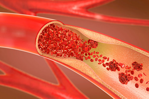 人活多久，看手背血管就知道！血管若有這六個特徵，恭喜你身體還算健康