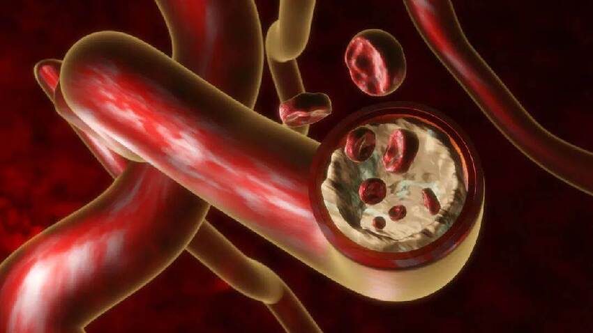 人活多久，看手背血管就知道！血管若有這六個特徵，恭喜你身體還算健康