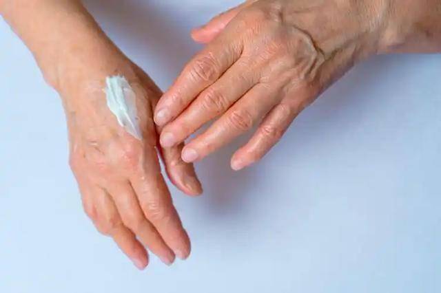 醫生提醒：身體2個部位瘙癢，或是糖尿病信號，別以為是皮膚病！