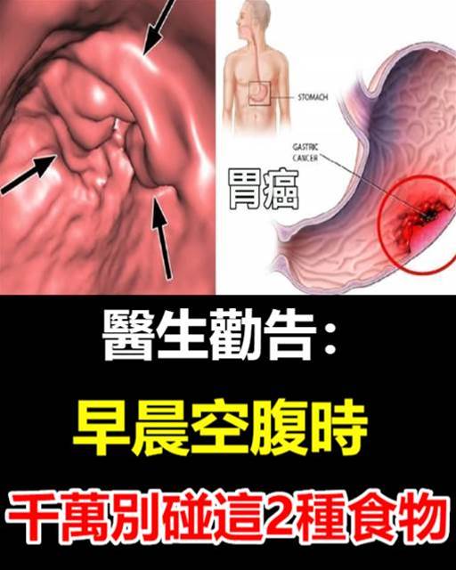 醫生勸告：早晨空腹時，千萬別吃這2種食物，會損傷胃粘膜，並加重原有的胃痛